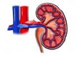 renal-arteries-stenosiS1.jpg