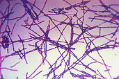 300px-Bacillus_anthracis_Gram.jpg
