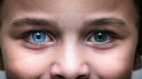 Heterochromia_faqs_678x446_compressed-1600x900.jpg